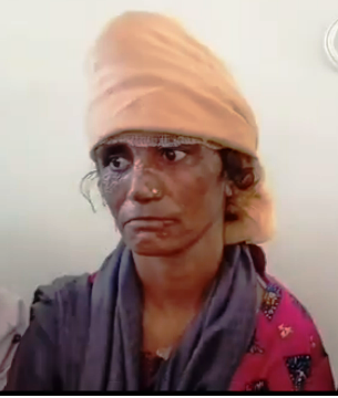 रिंडोलगांव की प्रीति की 15 दिनों से बंधक बनाकर दर्दनाक पिटाई की घटना का उत्तराखण्ड राज्य महिला आयोग ने लिया संज्ञान